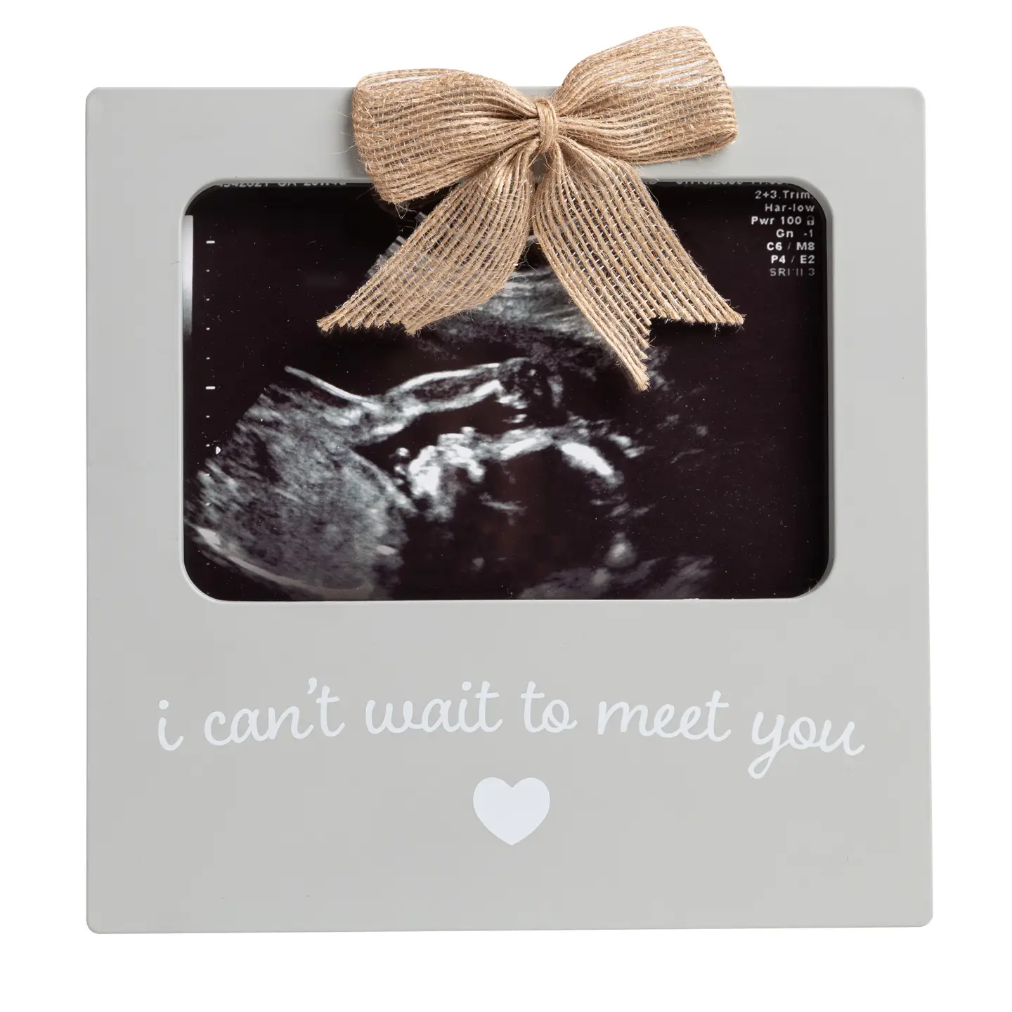 Ultrasound Frames Can't Wait to Meet You