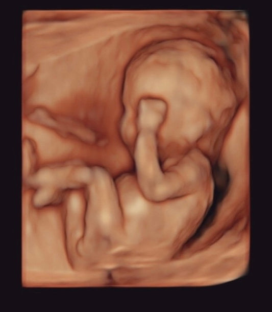 Ultrasound/Gender Testing